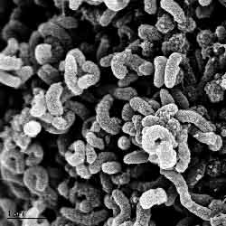 scanning electron microscope image of a piece of biofilm