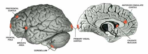Comparison of a human brain and chimpanzee