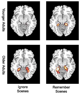 Brain scan photos