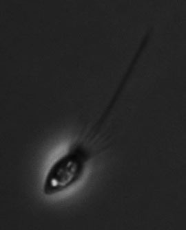 Microscope image of the choanoflagellate Monosiga brevicollis